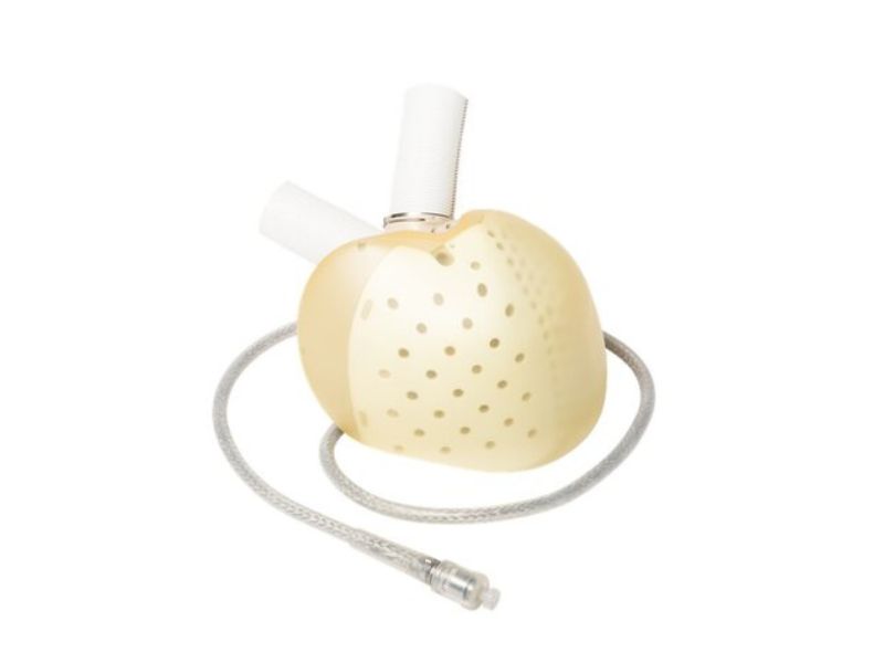 Coeur artificiel Carmat